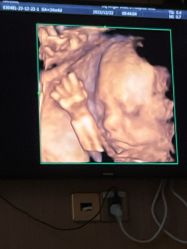 -重庆安琪儿妇产医院-妇幼保健联盟医院