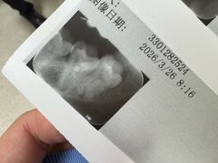 -北京大学口腔医院(第一门诊部)