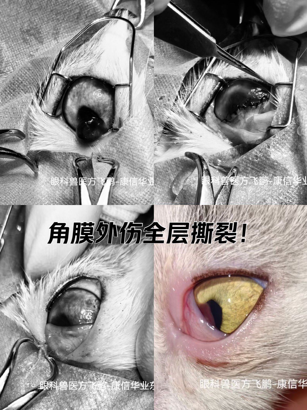 角膜外伤全层撕裂!