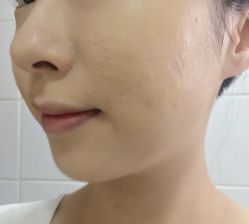 -Dr.ACNE痘院长祛痘皮肤管理全国连锁