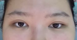 -JustHer宁波珈禾医疗美容医院