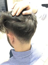 -大麦微针植发丨全国连锁