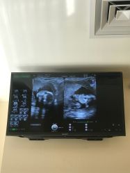 -上海艾儿贝佳妇产科医院