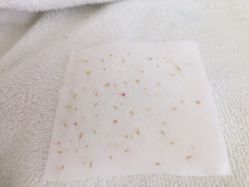 -苗方清颜专业祛痘连锁机构