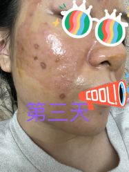 体验后-广州美莱医疗美容医院