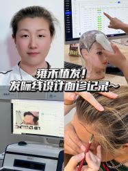 -雍禾植发全国连锁