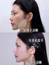 -Yestar重庆艺星医疗美容医院