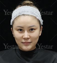 -Yestar艺星整形