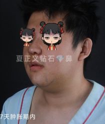 -北京米扬丽格医疗美容·联合丽格鼻整形中心