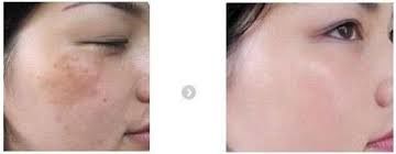 -SKINIST丽铂医疗美容