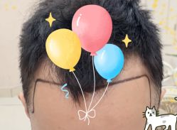 -大麦微针植发全国连锁