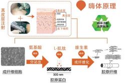 -应超小李飞刀整形