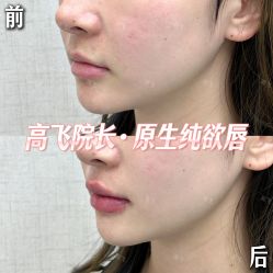 -深圳艺星医疗美容医院
