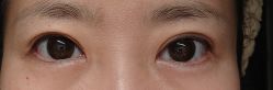 -天津伊美尔医疗整形美容专科医院