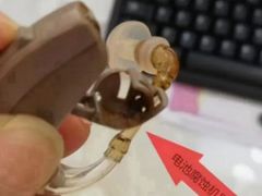 -自然之声助听器(平凉店)