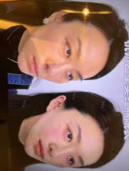 -Yestar杭州艺星医疗美容医院