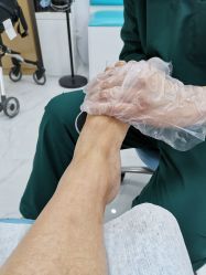 -派恩宜灰指甲鸡眼嵌甲手足癣