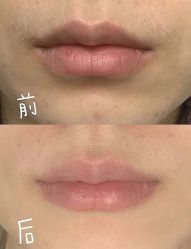 -薇兰专业脱毛连锁机构