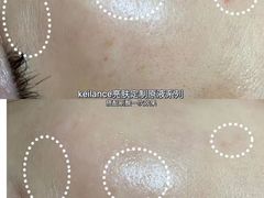 -艾通康缘艾灸.疼痛.睡眠养生馆(凤凰城店)