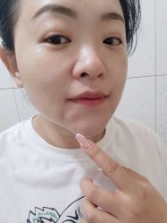 点击看大图 体验前-圣嘉新医疗美容医院