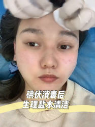 -西安壹加壹医疗美容·西北抗衰旗舰店