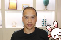 -大麦微针植发丨全国连锁