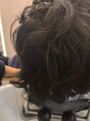 -碧莲盛不剃发植发