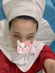 体验后-北京丽星翼美医疗美容
