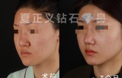 -北京米扬丽格医疗美容·联合丽格鼻整形中心