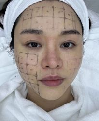 -深圳米兰柏羽医疗美容医院