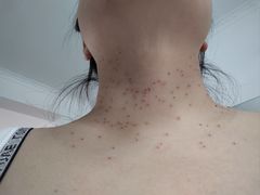 -大连市皮肤病医院