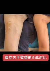 -瘦立方身材管理中心