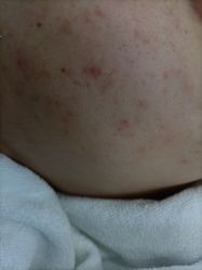 -蕾特恩专业祛痘·皮肤管理