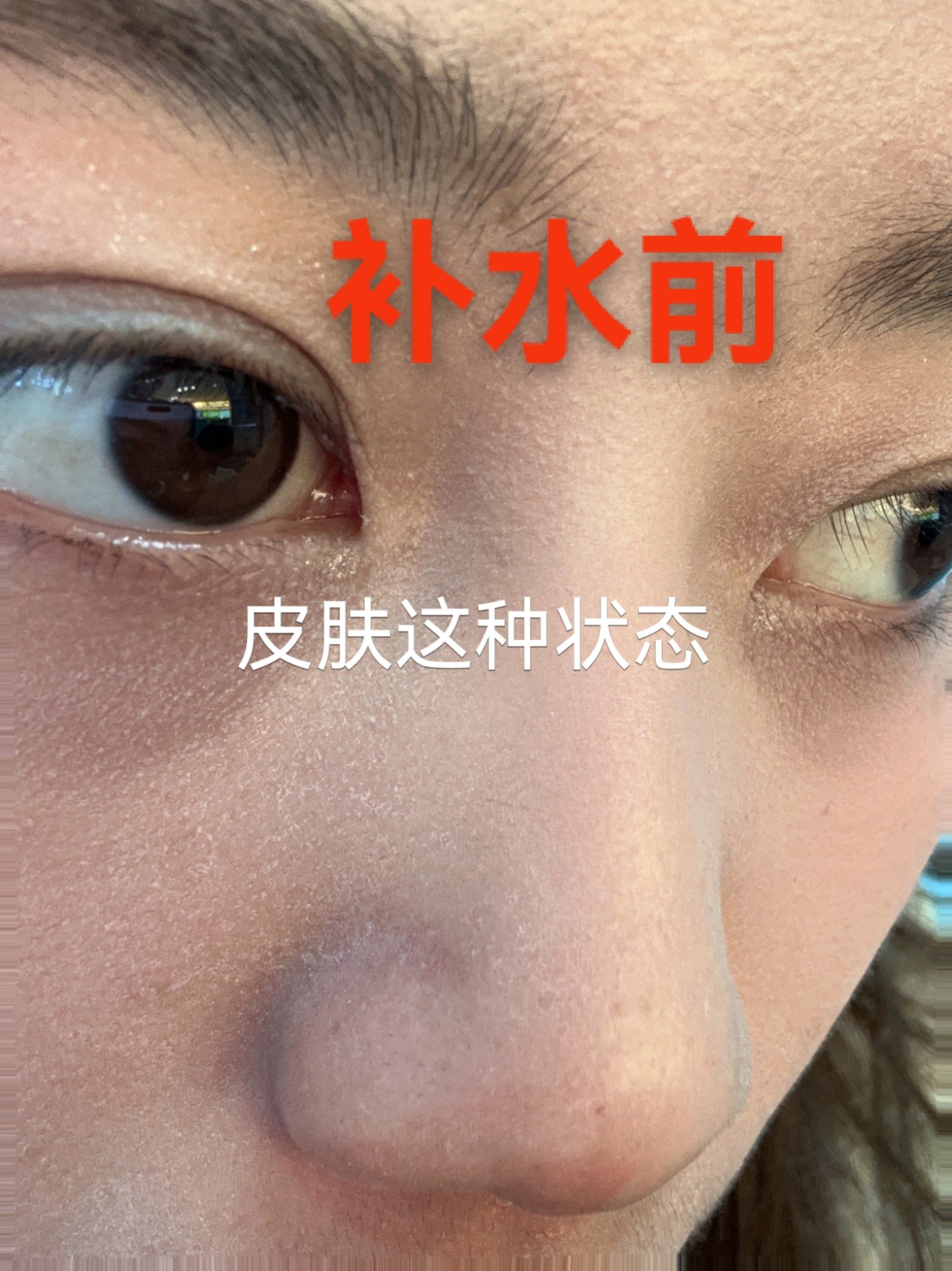 皮肤浮粉 卡粉 怎么办05