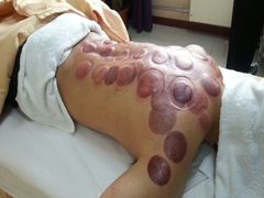 android_upload_pic-席仁堂推拿按摩脊柱调理(世纪科贸大厦店)