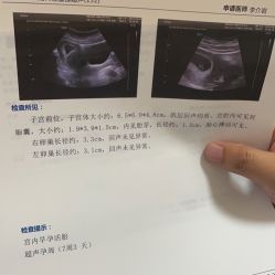 -北京妇产医院(东院)