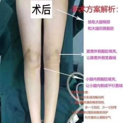 -上海漾颜医疗美容