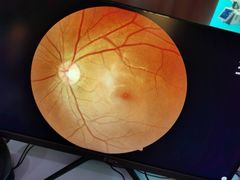 -宝岛眼镜(苏州浒关店)