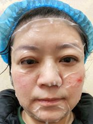 体验后-南京医科大学友谊整形外科医院