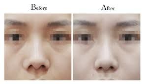 -SKINIST丽铂医疗美容