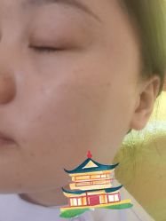 -长沙雅美医疗美容医院
