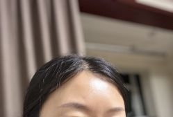 体验前-大连美天医疗美容医院