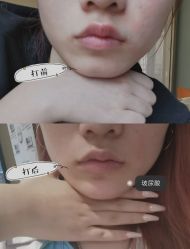 -上海漾颜医疗美容