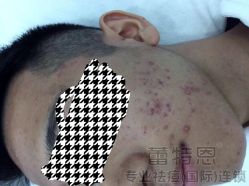 -蕾特恩专业祛痘·皮肤管理