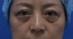 -天津健丽·去眼袋医疗美容机构