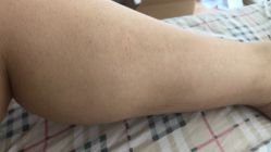 -洁铭新加坡医美