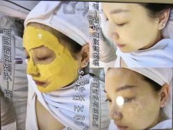 -SKIN79皮肤管理中心