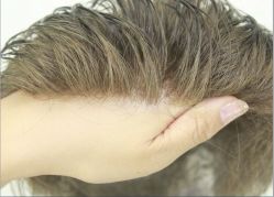 -发饰美男士增发补发假发定制店