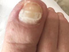 -郑远元专业修脚房(管庄店)