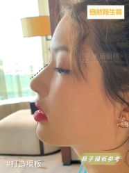 -北京米扬丽格医疗美容·联合丽格鼻整形中心